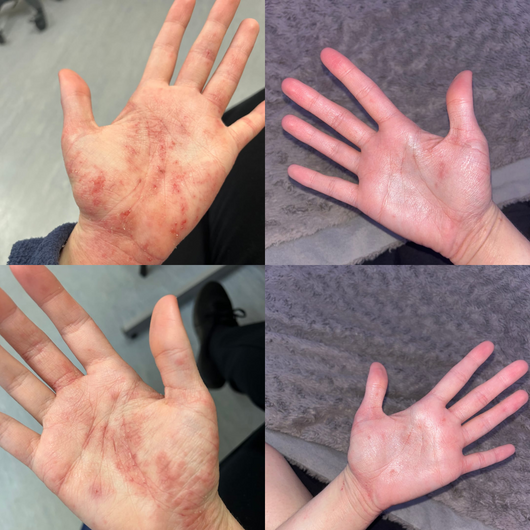 Crème Eczema Sea Moss